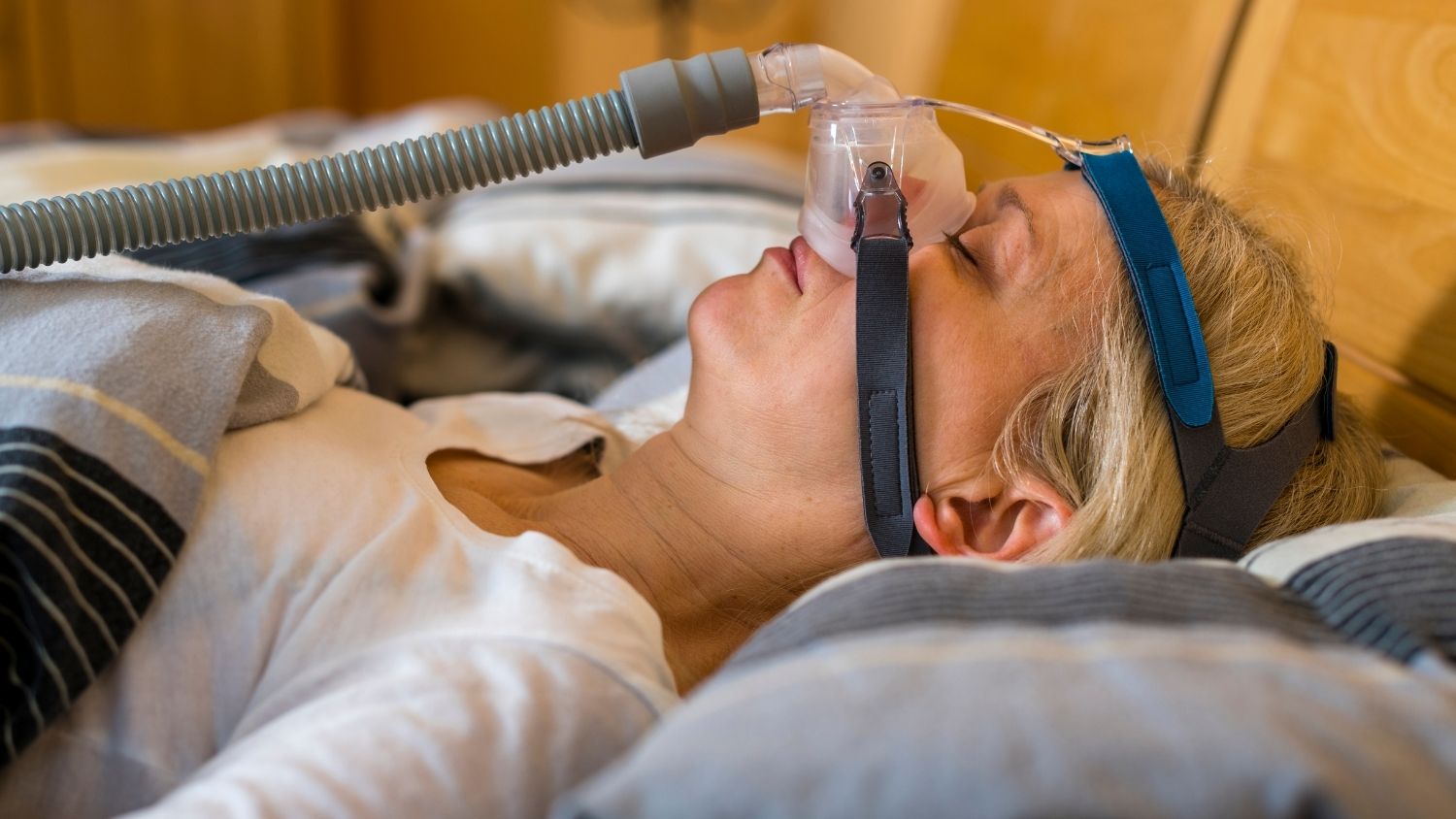 Dealing with the irritation that come from CPAP masks