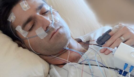 sleep testing Canberra